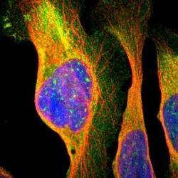 NMT2 Antibody, Novus Biologicals:Antibodies:Primary Antibodies